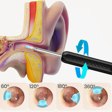 Wireless WiFi Ear Pick Otoscope Camera Borescope Luminous Ear Wax Cleaning Kit