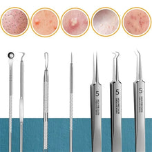 11pcs Acne Pimples Blackhead Remover Clip Facial Cleaner
