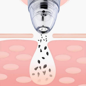5 Nozzle Facial Blackhead Remover Pore Cleaner- USB Charging_5
