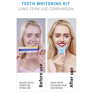 Teeth Whitening Kit with LED Light Professional Oral Cleaning Machine_4