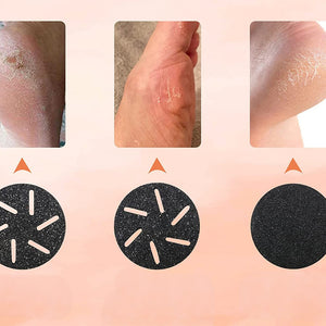 Electric Foot File Pedicure Callus Remover_6