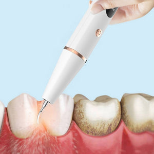 Ultrasonic Electric Tooth Scaler