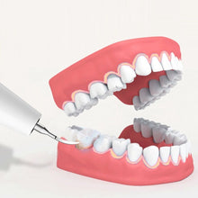 Ultrasonic Electric Tooth Scaler