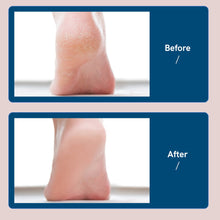 Rechargeable Electric Foot Callus Remover