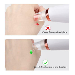6 Nozzle Electric Acne Pimple Blackhead Remover Pore Deep Cleaner