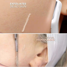 Flawless Dermaplane Facial Hair Remover